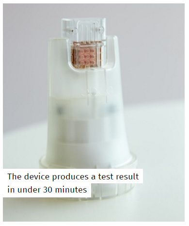 30 Minutes HIV Detection Using USB-Stick